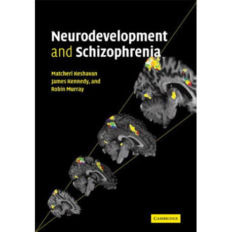 Neurodevelopment and Schizophrenia